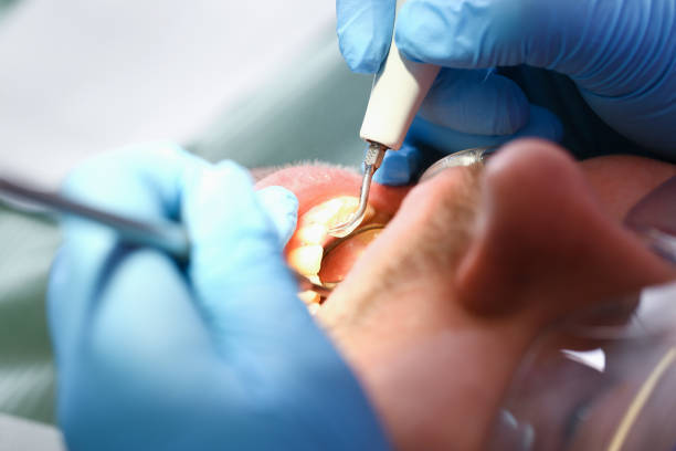 Best Walk-In Emergency Dental Services in Union, SC