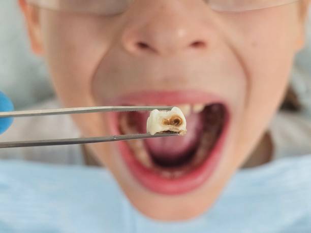 Best Emergency Pediatric Dental Care in Union, SC